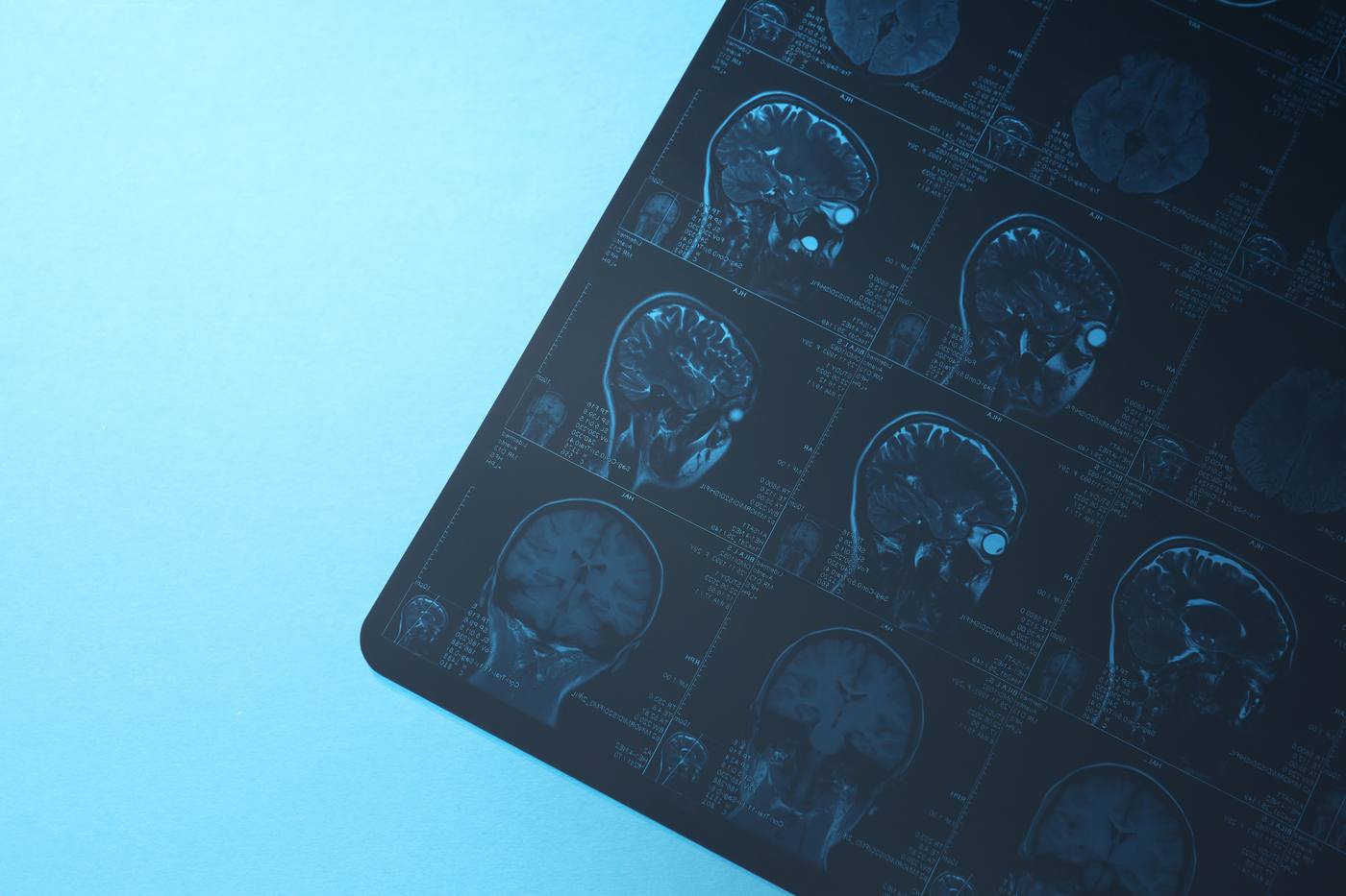 Medical expert and attorney discussing case findings over diagnostic images